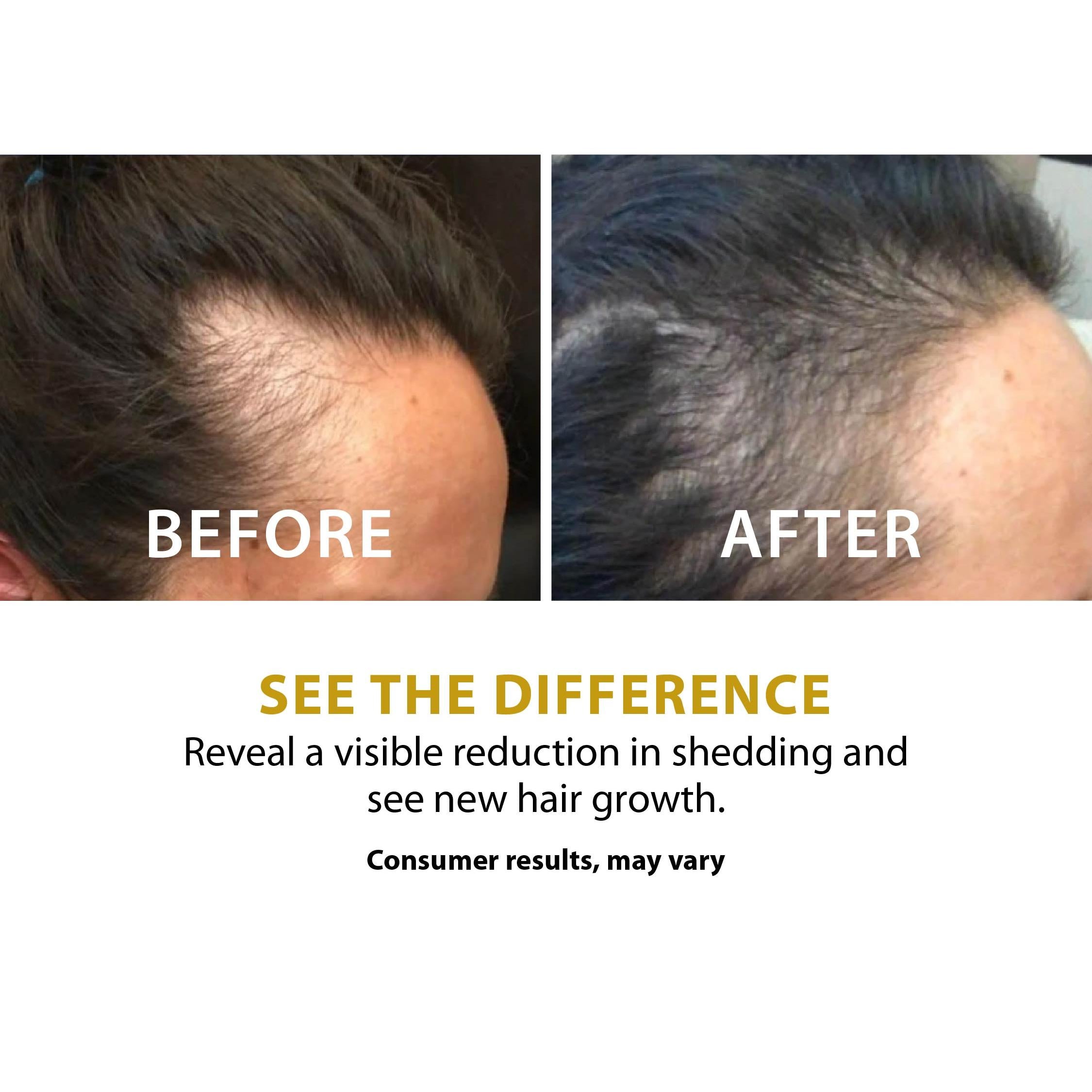 Folix22 100% Organic Formula™