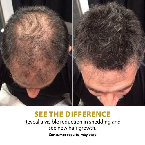 Folix22 100% Organic Formula™